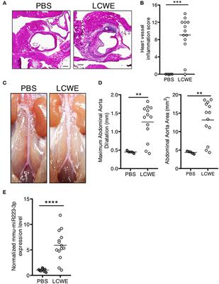 MicroRNA-223 Regulates the Development of Cardiovascular Lesions in LCWE-Induced Murine Kawasaki Disease Vasculitis by Repressing the NLRP3 Inflammasome